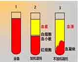 血清、血浆和全血怎么分？